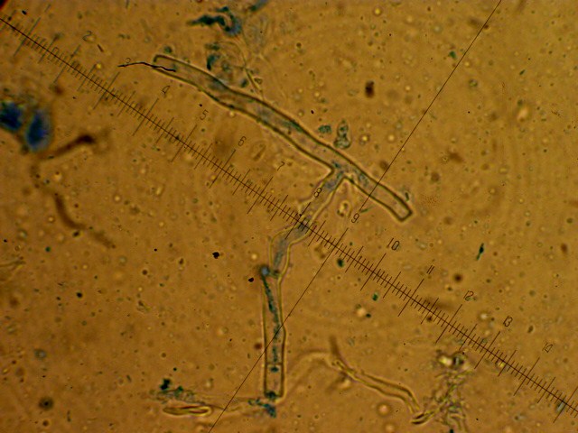 Lindtneria trachyspora (Tulasnella violea)